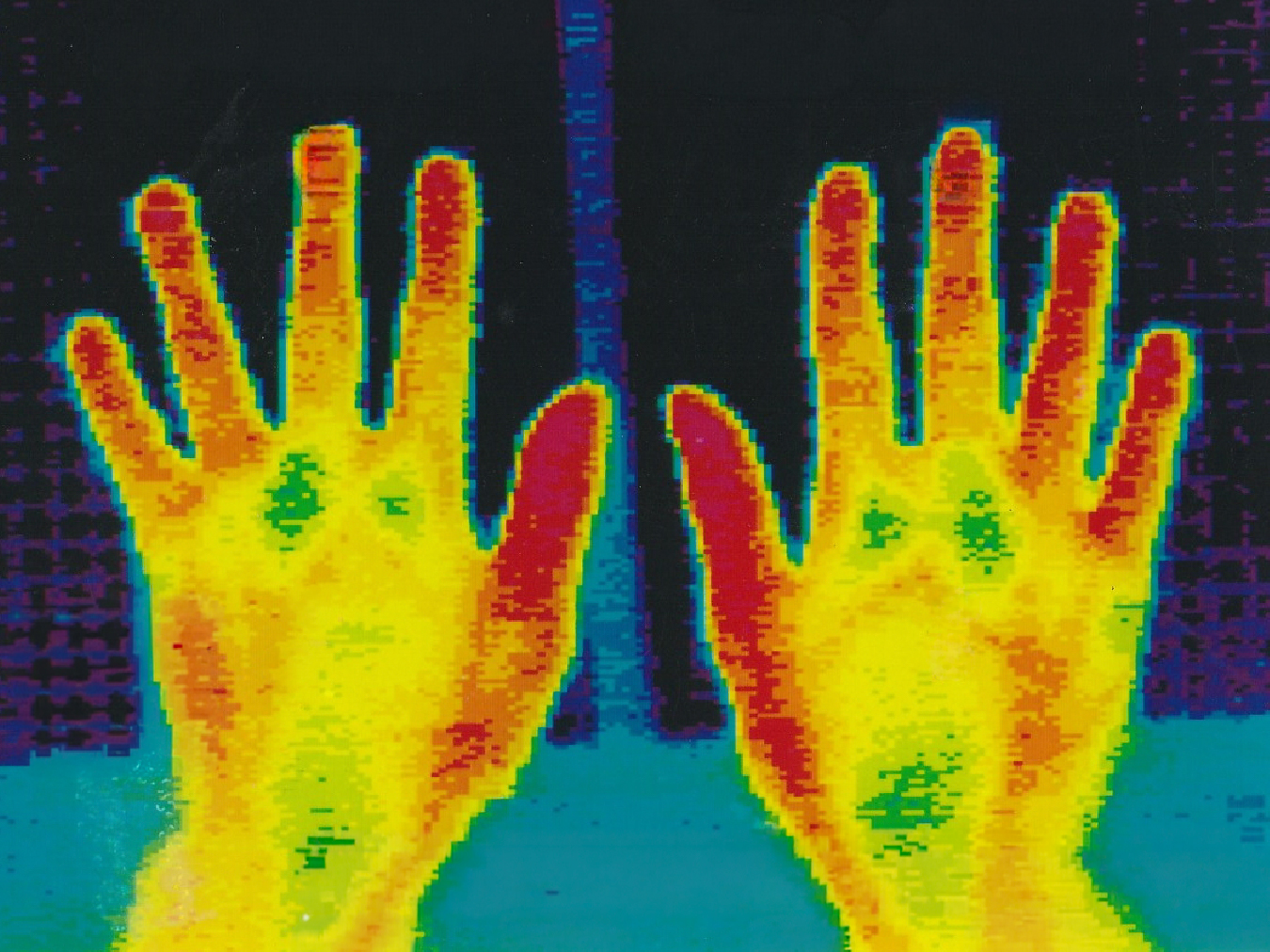 手のサーモグラフィ画像